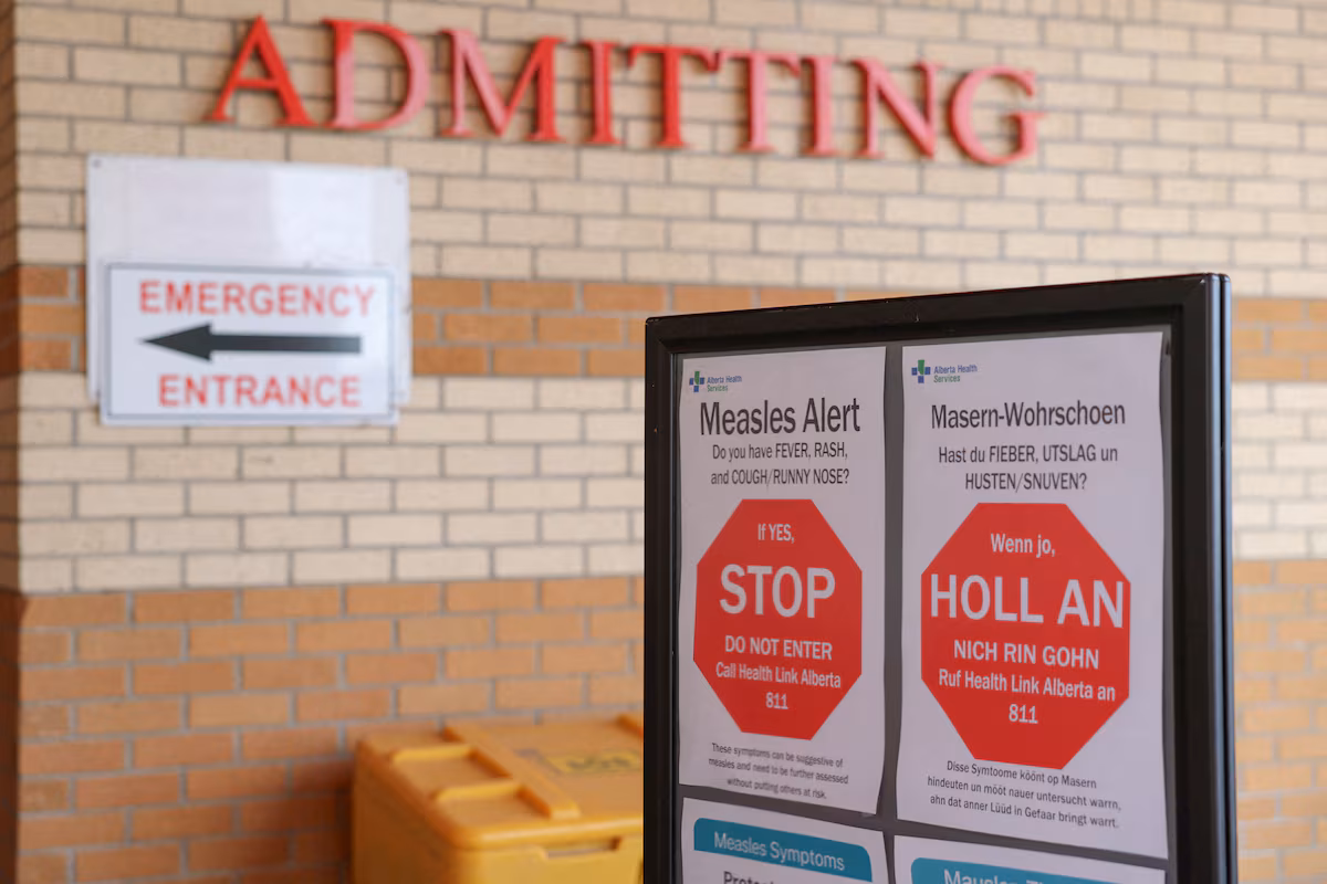 Pregnancy and measles: practical advice after Alberta’s delayed disclosure